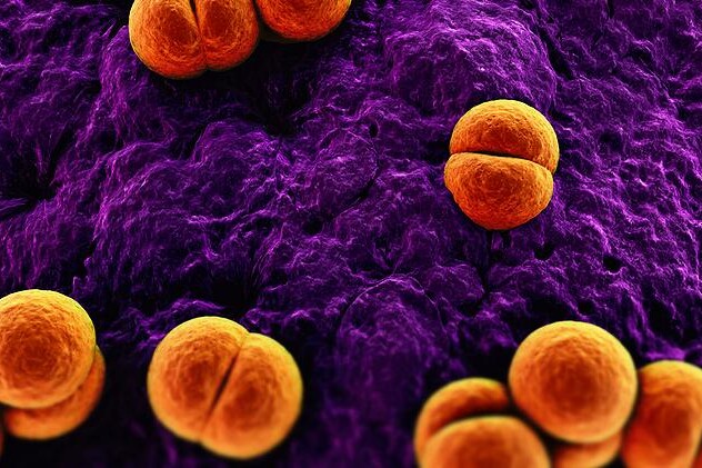 Záněty mozkových blan - meningitidy