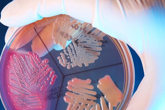 Bakteriální infekce