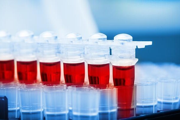 Glykovaný hemoglobin