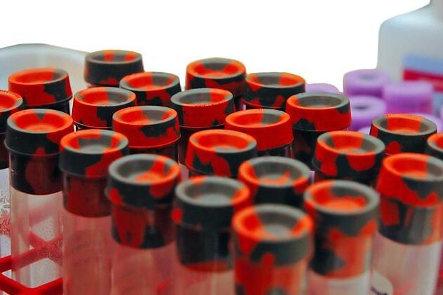 Příznaky těhotenské cukrovky