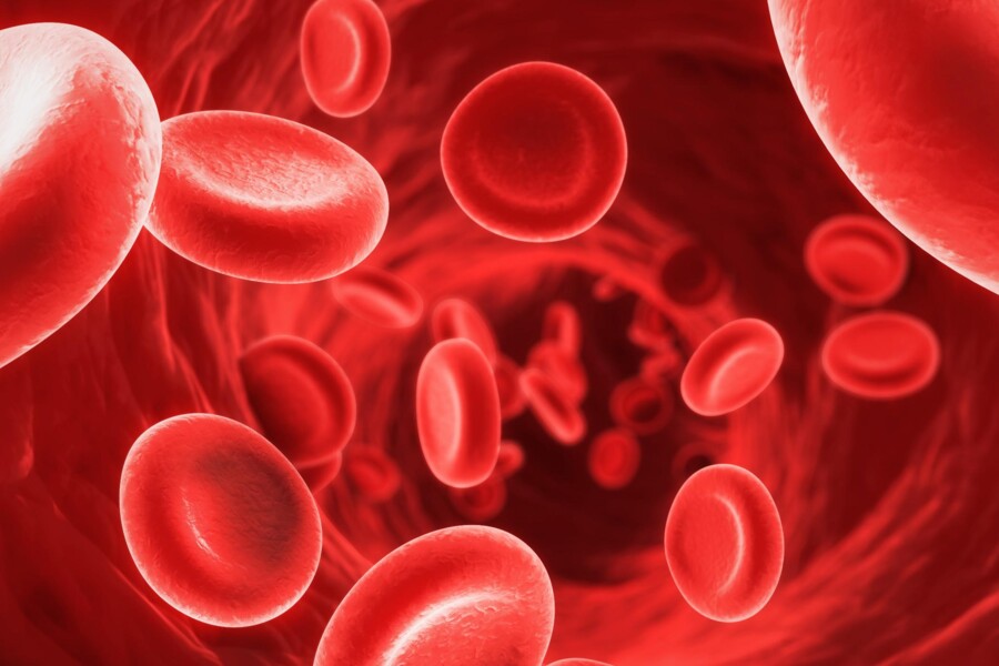 Anémie z nedostatku železa