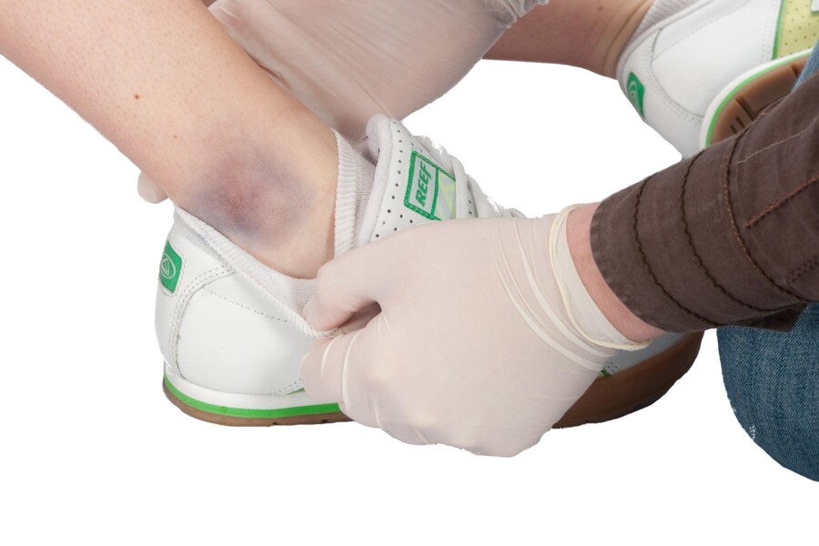 První pomoc při zlomeninách kostí