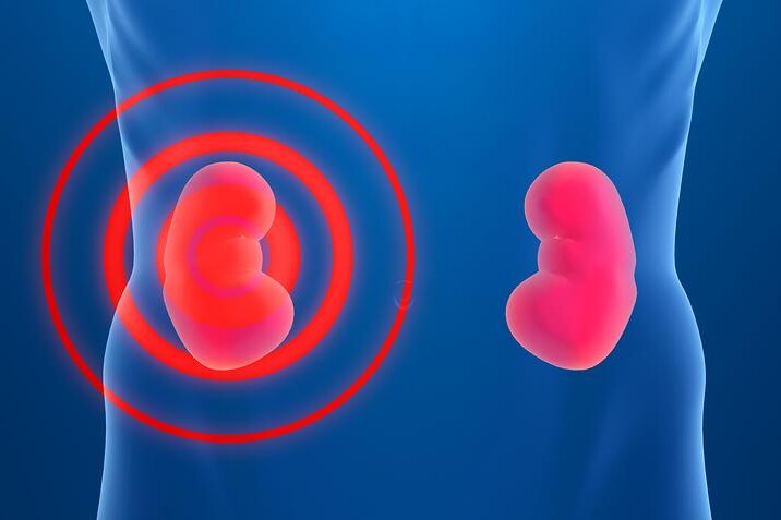 Chronické selhání ledvin