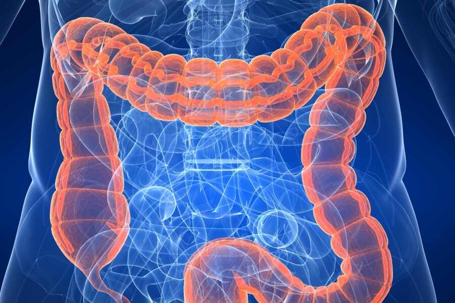 Vředový zánět tlustého střeva u dětí