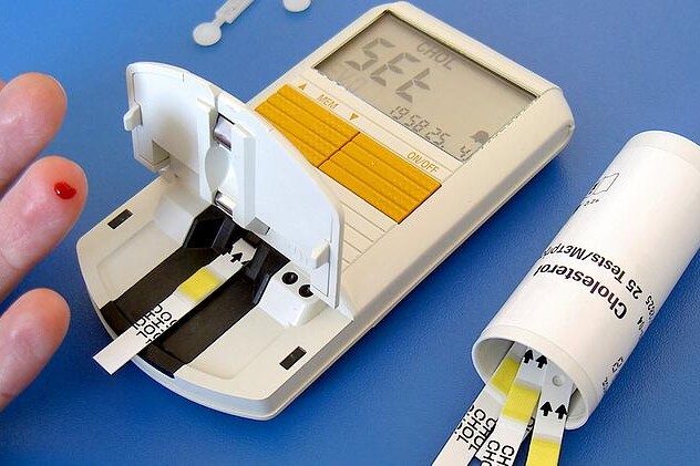 Cholesterol jako laboratorní hodnota