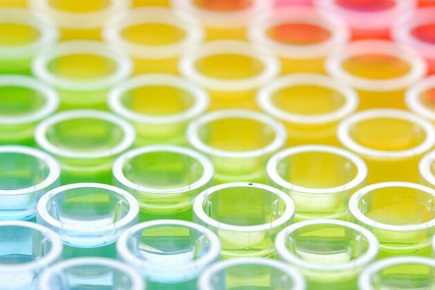 GGT - Gama-glutamyltransferáza