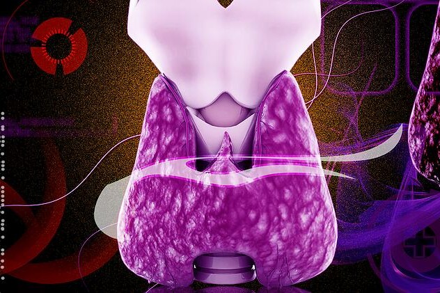 Rakovina štítné žlázy