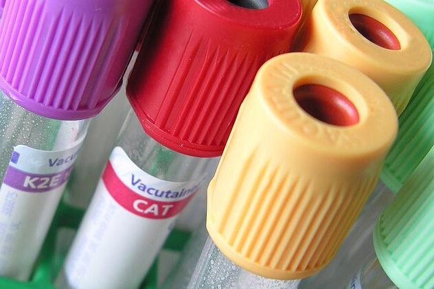 Imunitní poruchy těhotenství