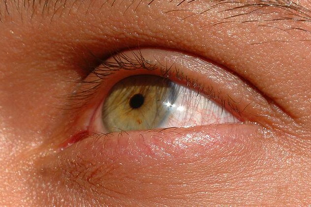 Prevence šedého zákalu