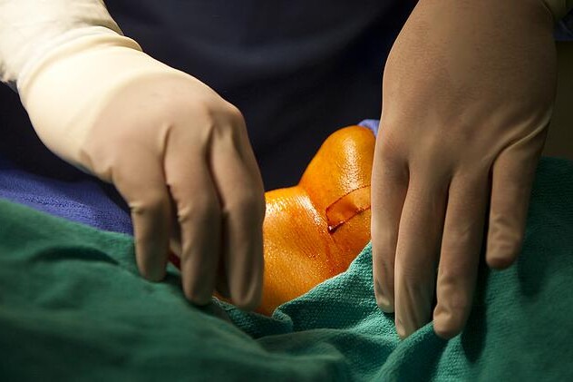 Chirurgická léčba štítné žlázy