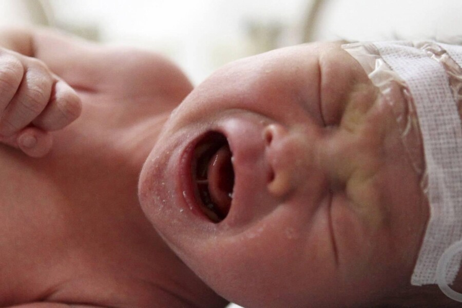 Periventrikulární leukomalacie