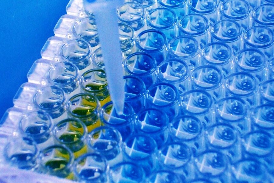 Infekční mononukleóza