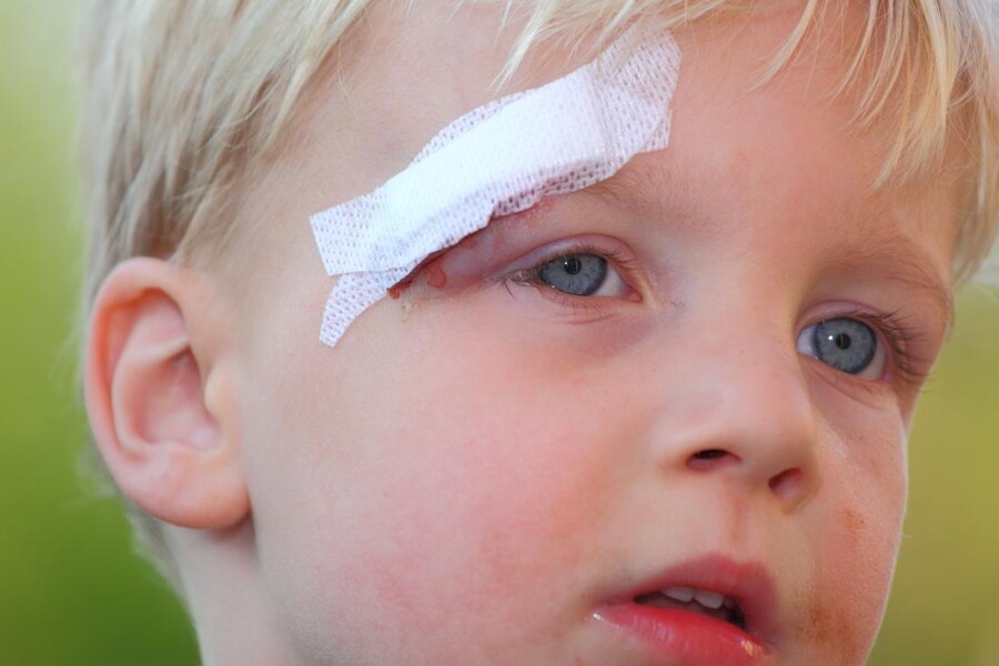 První pomoc u řezných a otevřených ran u dětí