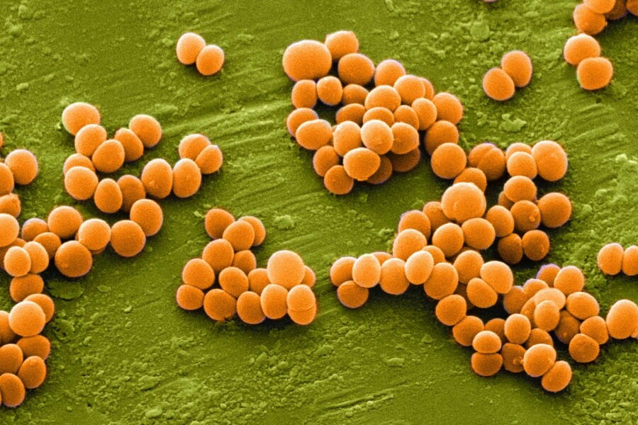 Stafylokoková enterotoxikóza