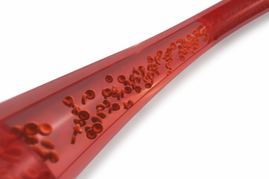 Hemolytická anémie u dětí