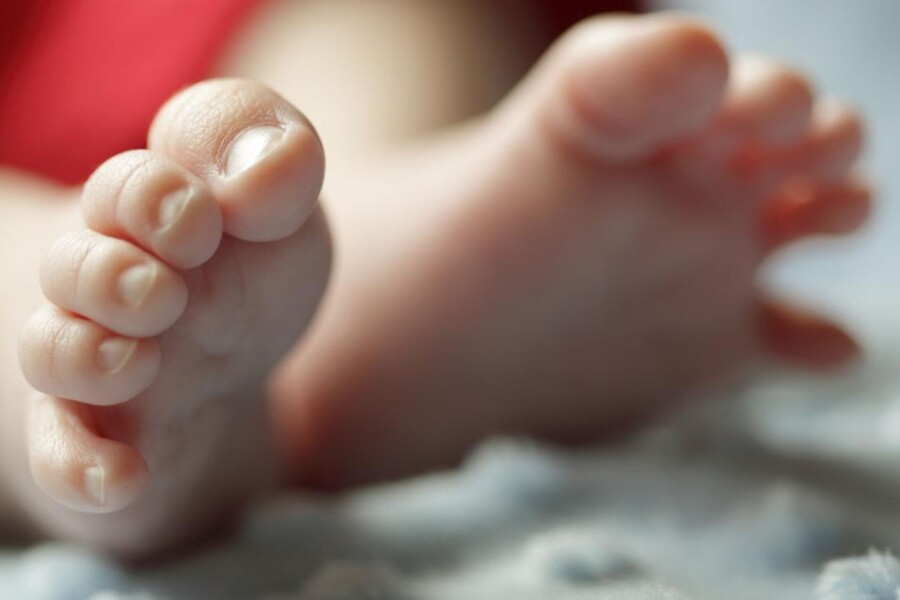 Zarostlé nehty na nohou u dětí