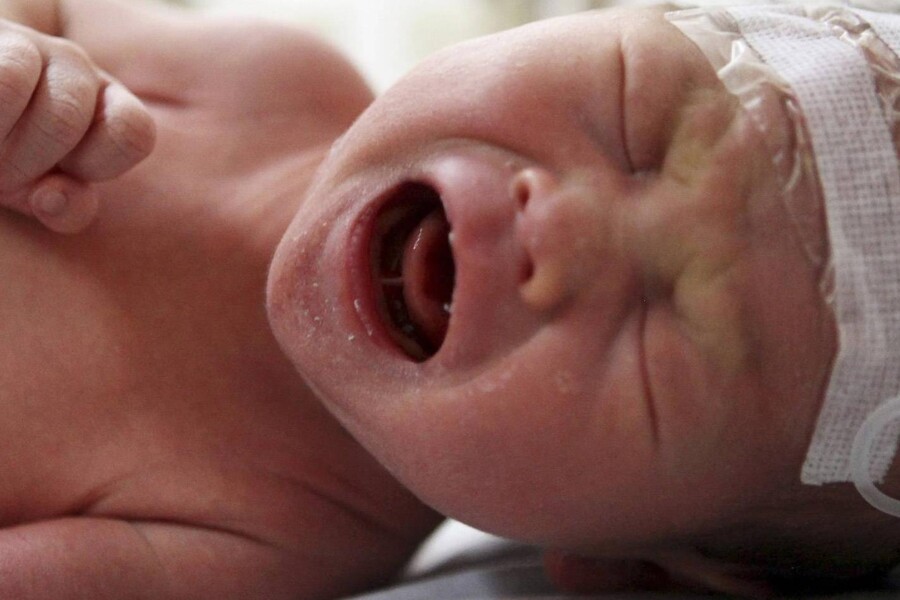 Nekrotizující enterokolitida