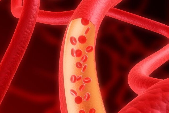 Transpozice velkých tepen u dětí