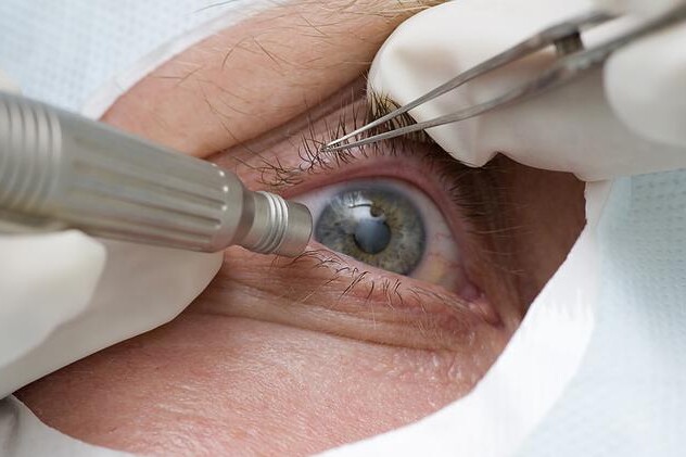 Katarakta neboli šedý zákal