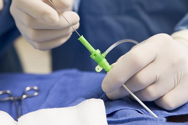 Srdeční vady v dospělosti