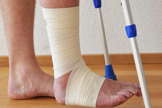 Zánět žil - léčba