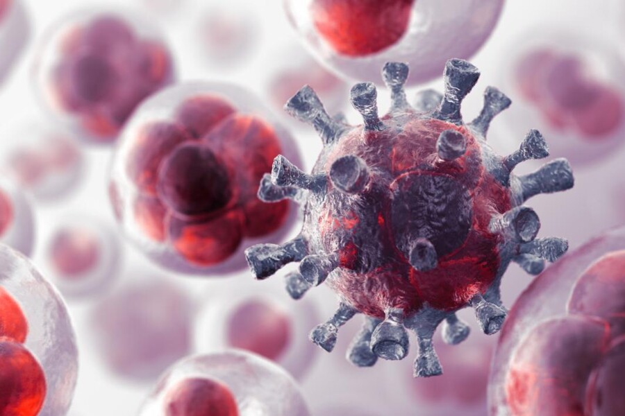 Neuroblastom u dětí