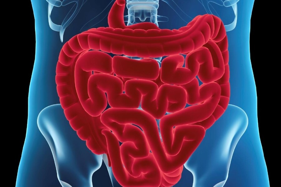 Vchlípení střeva u dětí