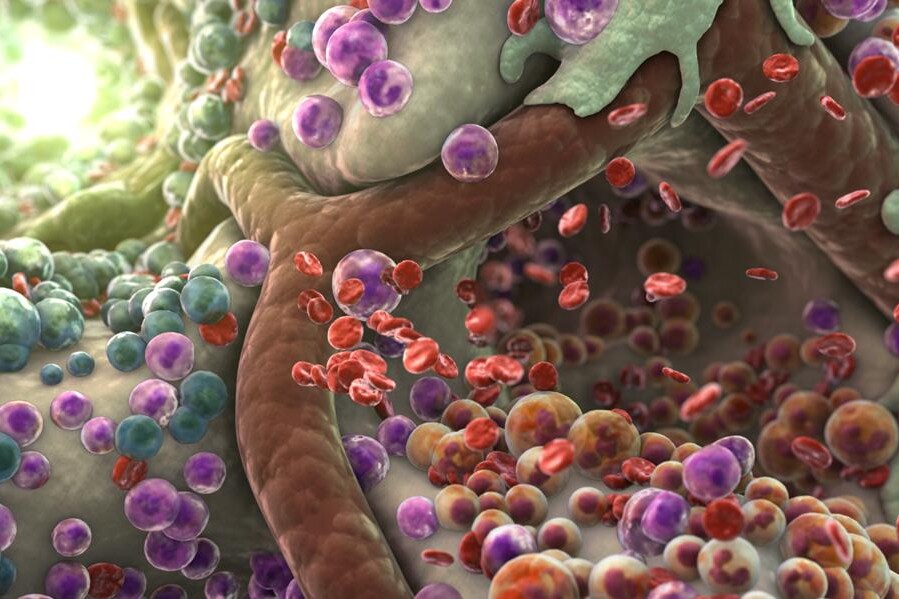 Aplastická anémie u dětí