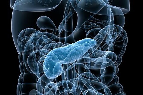 Chronický zánět slinivky  