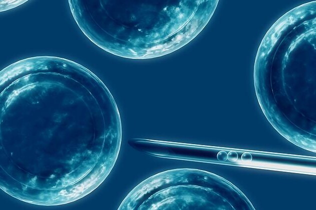 IVF - in vitro fertilizace