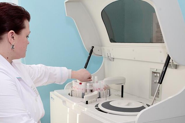 AST - Aspartátaminotransferáza 