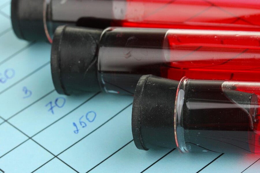 Poruchy krvácivosti u dětí