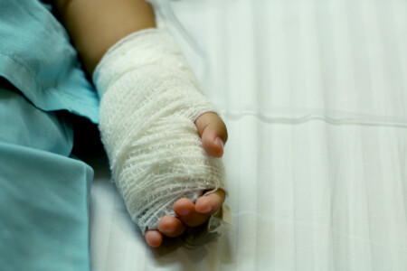 Epidermolysis bullosa – nemoc motýlích křídel