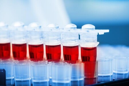 Glykovaný hemoglobin