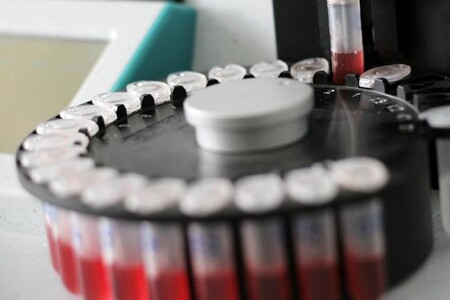 Fe - Železo v séru