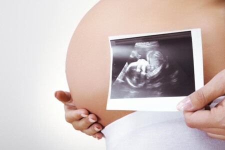 Eklampsie a preeklampsie