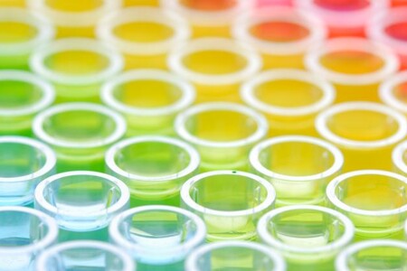 GGT - Gama-glutamyltransferáza