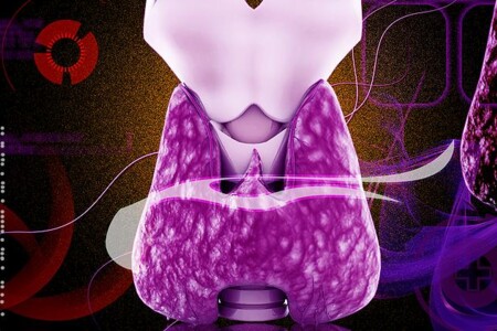 Rakovina štítné žlázy 