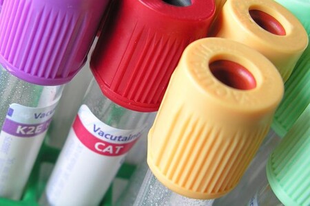 Imunitní poruchy těhotenství