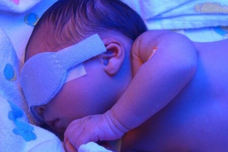 Žloutenka novorozenců