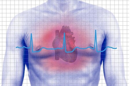 Následky infarktu myokardu