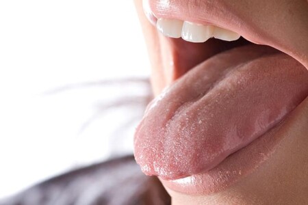 Bílý povlak na jazyku