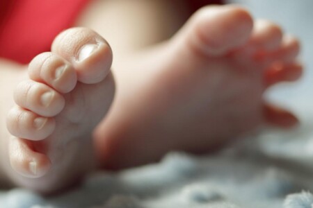 Zarostlé nehty na nohou u dětí