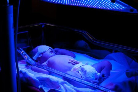 Atrézie žlučovodu