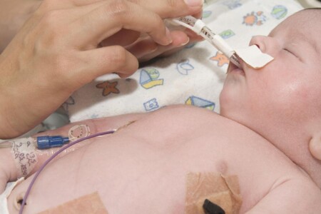 Poruchy močovinového cyklu