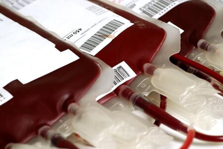 Anémie - chudokrevnost