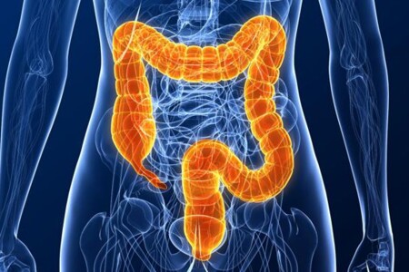 Střevní neprůchodnost u dětí