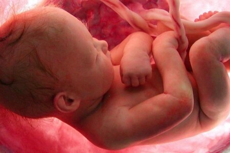 Vývojové etapy plodu ve fetálním období