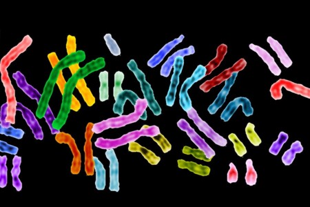 Turnerův syndrom u dětí