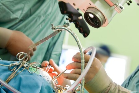 Současná léčba nádorů mozku 